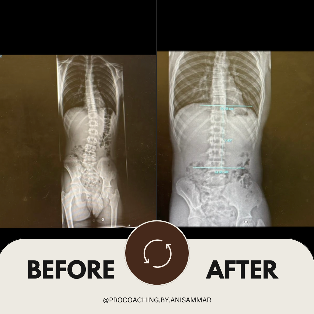 rugklachten pro coaching by anis ammar